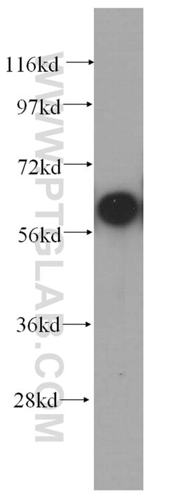 COASY Rabbit anti-Human, Mouse, Rat, Polyclonal, Proteintech 150 &mu;L;