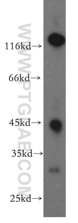 SIRT7 Rabbit anti-Human, Mouse, Rat, Polyclonal, Proteintech 150 &mu;L;