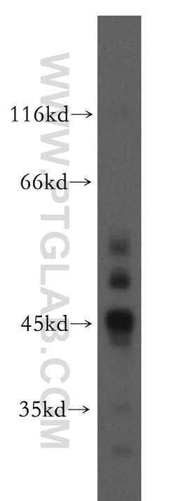 SIRT7 Rabbit anti-Human, Mouse, Rat, Polyclonal, Proteintech 150 &mu;L;