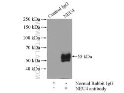NEU4 Rabbit anti-Human, Polyclonal, Proteintech 150 &mu;L; Unconjugated:Antibodies,