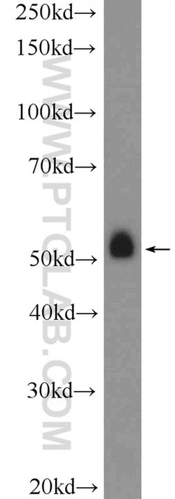 NEU4 Rabbit anti-Human, Polyclonal, Proteintech 150 &mu;L; Unconjugated:Antibodies,