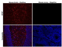 Invitrogen GFAP Monoclonal Antibody (2.2B10) 100 &mu;g; Unconjugated:Antikroppar
