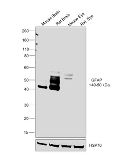 Invitrogen GFAP Monoclonal Antibody (2.2B10) 100 &mu;g; Unconjugated:Antibodies,