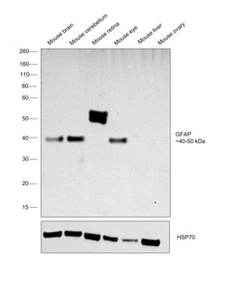 Invitrogen GFAP Monoclonal Antibody (2.2B10) 100 &mu;g; Unconjugated:Antikroppar