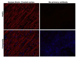 Invitrogen MAP2 Monoclonal Antibody (M13) 100 &mu;g; Unconjugated:Antibodies,