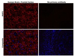 Invitrogen MAP2 Monoclonal Antibody (M13) 100 &mu;g; Unconjugated:Antibodies,