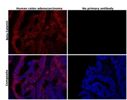 Invitrogen beta Catenin Monoclonal Antibody (CAT-5H10) 100 &mu;g; Unconjugated:Antibodies,