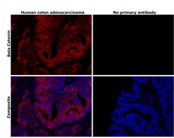Invitrogen beta Catenin Monoclonal Antibody (CAT-5H10) 100 &mu;g; Unconjugated:Antibodies,