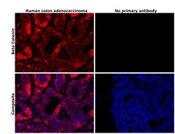 Invitrogen beta Catenin Monoclonal Antibody (CAT-5H10) 100 &mu;g; Unconjugated:Antibodies,