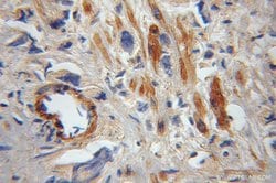 FAIM Rabbit anti-Human, Mouse, Rat, Polyclonal, Proteintech:Antibodies:Primary