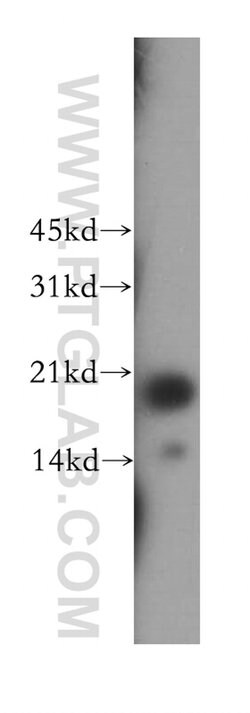 FAIM Rabbit anti-Human, Mouse, Rat, Polyclonal, Proteintech:Antibodies:Primary