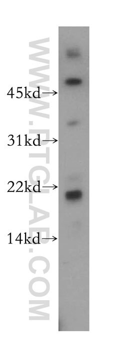 FAIM Rabbit anti-Human, Mouse, Rat, Polyclonal, Proteintech