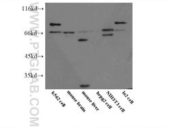 STAM2 Rabbit anti-Human, Mouse, Rat, Polyclonal, Proteintech 150 &mu;L;