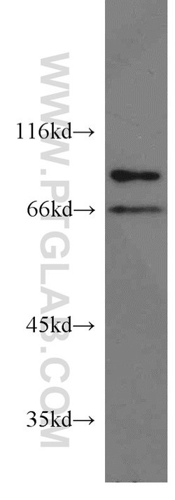 STAM2 Rabbit anti-Human, Mouse, Rat, Polyclonal, Proteintech 150 &mu;L;