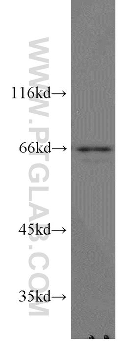 STAM2 Rabbit anti-Human, Mouse, Rat, Polyclonal, Proteintech 150 &mu;L;