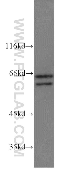 STAM2 Rabbit anti-Human, Mouse, Rat, Polyclonal, Proteintech 150 &mu;L;