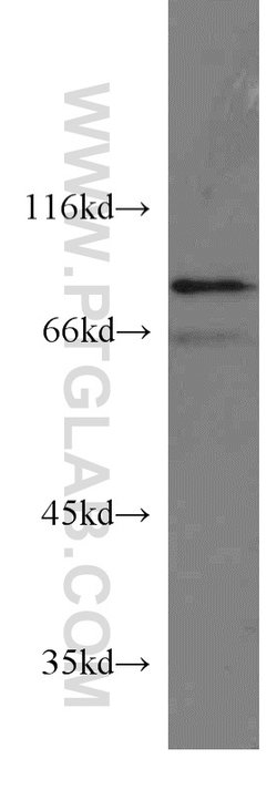 STAM2 Rabbit anti-Human, Mouse, Rat, Polyclonal, Proteintech 150 &mu;L;