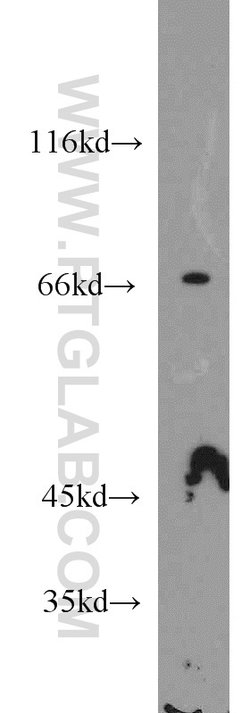 STAM2 Rabbit anti-Human, Mouse, Rat, Polyclonal, Proteintech 150 &mu;L;