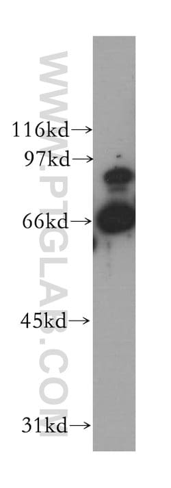 STAM2 Rabbit anti-Human, Mouse, Rat, Polyclonal, Proteintech 150 &mu;L;