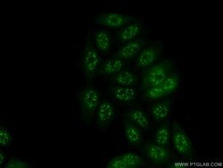 ETV5 Rabbit anti-Human, Mouse, Rat, Polyclonal, Proteintech 150 &mu;L;