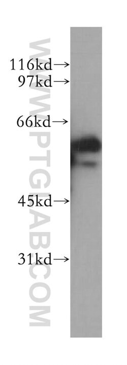 ETV5 Rabbit anti-Human, Mouse, Rat, Polyclonal, Proteintech 150 &mu;L;