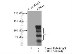 EPB41 Rabbit anti-Human, Mouse, Rat, Polyclonal, Proteintech 150 &mu;L;