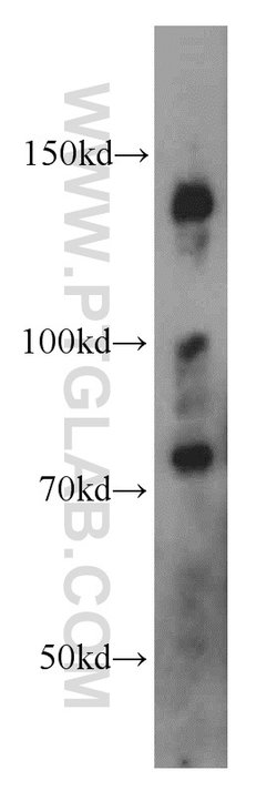 EPB41 Rabbit anti-Human, Mouse, Rat, Polyclonal, Proteintech 150 &mu;L;