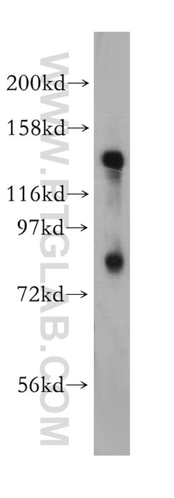 EPB41 Rabbit anti-Human, Mouse, Rat, Polyclonal, Proteintech 150 &mu;L;