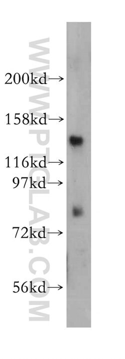 EPB41 Rabbit anti-Human, Mouse, Rat, Polyclonal, Proteintech 150 &mu;L;