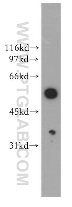 DBNL Rabbit anti-Human, Mouse, Rat, Polyclonal, Proteintech 20 &mu;L; Unconjugated:Antibodies,