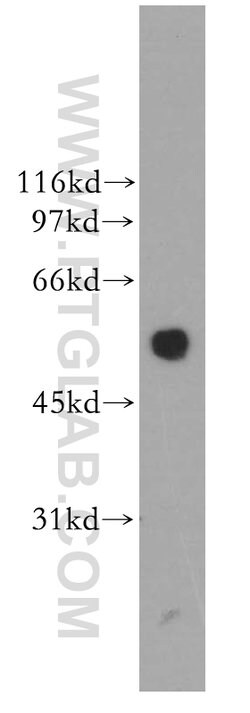 DBNL Rabbit anti-Human, Mouse, Rat, Polyclonal, Proteintech 20 &mu;L; Unconjugated:Antibodies,