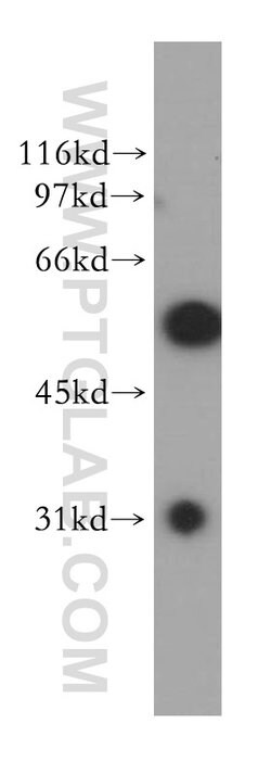 DBNL Rabbit anti-Human, Mouse, Rat, Polyclonal, Proteintech 20 &mu;L; Unconjugated:Antibodies,