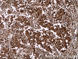 DBNL Rabbit anti-Human, Mouse, Rat, Polyclonal, Proteintech 20 &mu;L; Unconjugated:Antibodies,