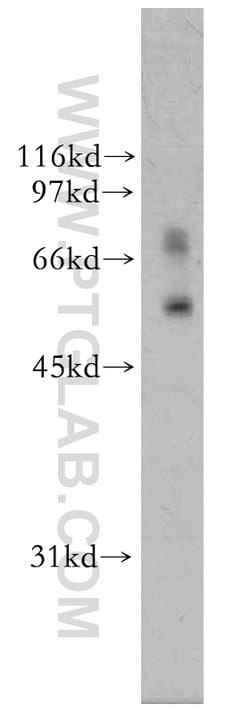 FBX15 Rabbit anti-Human, Mouse, Polyclonal, Proteintech:Anticorps:Anticorps
