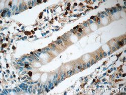 L-Plastin Rabbit anti-Human, Mouse, Rat, Polyclonal, Proteintech 20 &mu;L;