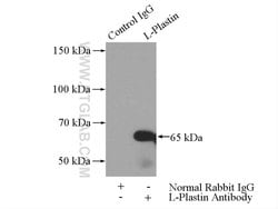 L-Plastin Rabbit anti-Human, Mouse, Rat, Polyclonal, Proteintech 20 &mu;L;