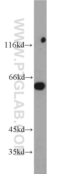 L-Plastin Rabbit anti-Human, Mouse, Rat, Polyclonal, Proteintech 20 &mu;L;