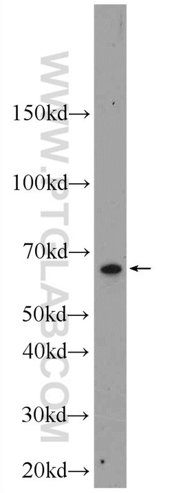 L-Plastin Rabbit anti-Human, Mouse, Rat, Polyclonal, Proteintech 20 &mu;L;