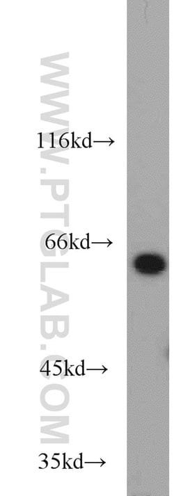 L-Plastin Rabbit anti-Human, Mouse, Rat, Polyclonal, Proteintech 20 &mu;L;