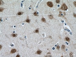 HuA/B/C/D Rabbit anti-Human, Mouse, Rat, Zebrafish, Polyclonal, Proteintech:Antibodies:Primary