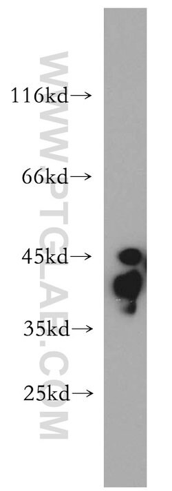 HuA/B/C/D Rabbit anti-Human, Mouse, Rat, Zebrafish, Polyclonal, Proteintech:Antibodies:Primary