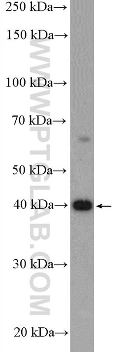 HuA/B/C/D Rabbit anti-Human, Mouse, Rat, Zebrafish, Polyclonal, Proteintech:Antibodies:Primary