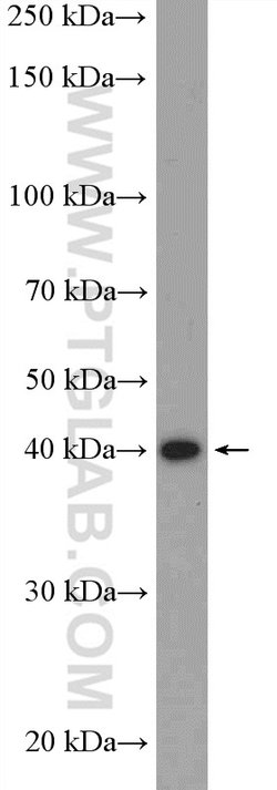 HuA/B/C/D Rabbit anti-Human, Mouse, Rat, Zebrafish, Polyclonal, Proteintech:Antibodies:Primary