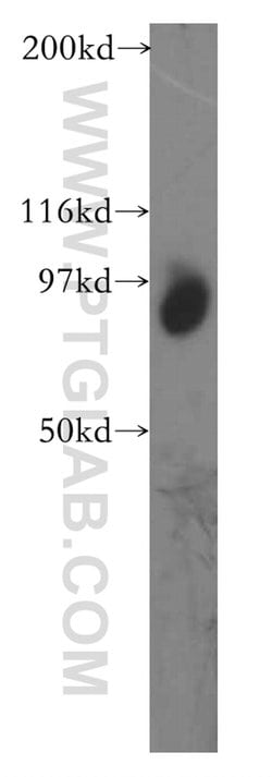 TGS1 Rabbit anti-Human, Mouse, Rat, Polyclonal, Proteintech 150 &mu;L;