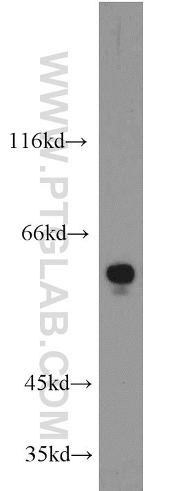 RAD9A Rabbit anti-Human, Polyclonal, Proteintech 20 &mu;L; Unconjugated:Antibodies,