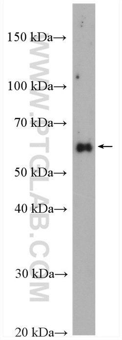 RAD9A Rabbit anti-Human, Polyclonal, Proteintech 20 &mu;L; Unconjugated:Antibodies,