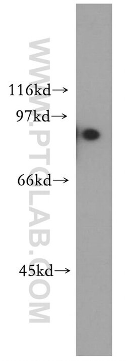 TRIM37 Rabbit anti-Human, Mouse, Rat, Polyclonal, Proteintech 150 &mu;L;