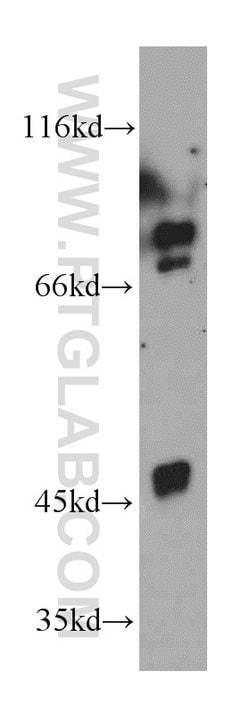 TRIM37 Rabbit anti-Human, Mouse, Rat, Polyclonal, Proteintech 150 &mu;L;