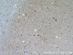 GRID1 Rabbit anti-Human, Mouse, Rat, Polyclonal, Proteintech 150 &mu;L;