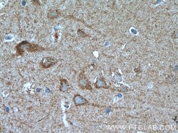 GRID1 Rabbit anti-Human, Mouse, Rat, Polyclonal, Proteintech 150 &mu;L;